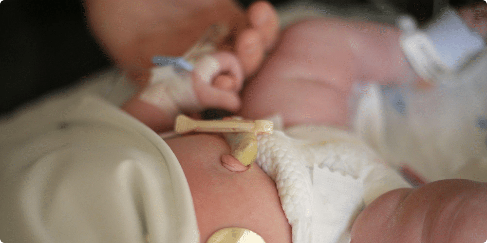 Comprendre le fonctionnement d'un babyphone multidirectionnel